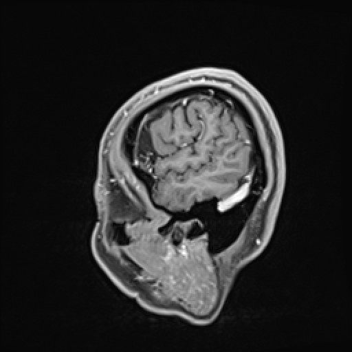 Click on the Serie image to view the images of VILLANUEVA, WILLIAM A.